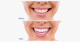 White Radiant Smile Home Kit - FREE SHIP DEALS