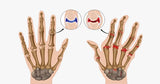 Arthritis Gloves - FREE SHIP DEALS